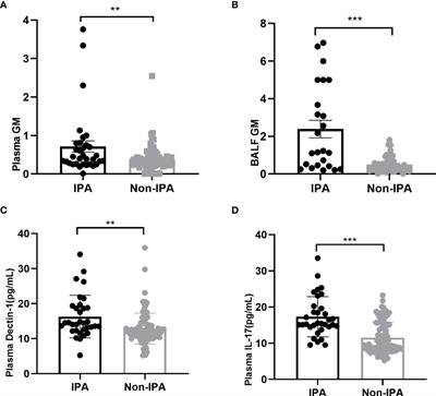 Diagnosis values of Dectin-1 and IL-17 levels in plasma for invasive pulmonary aspergillosis in bronchiectasis